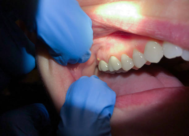 Best Emergency TMJ Treatment in Washington, DC