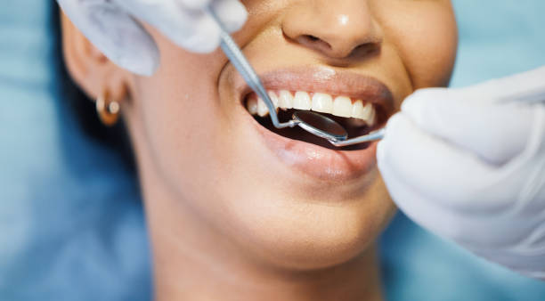 Best Emergency Wisdom Teeth Removal in Washington, DC