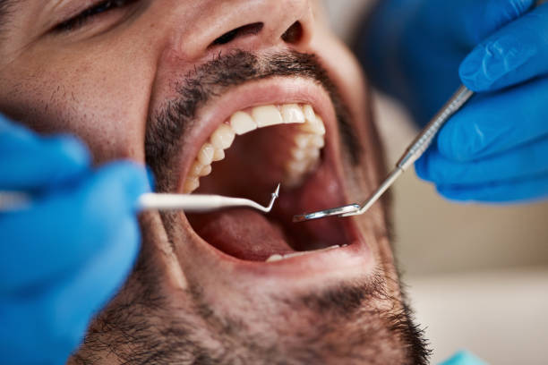 Best Emergency Dental Care for Broken or Chipped Teeth in Washington, DC