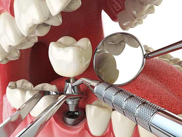Best Emergency Treatment for Dental Infections or Abscesses in Washington, DC
